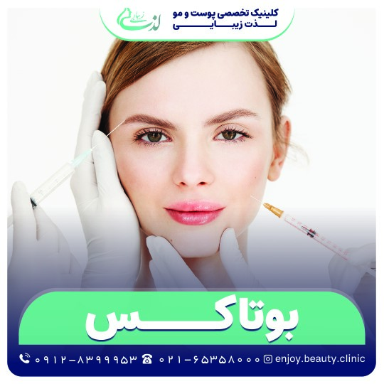 بوتاکس
