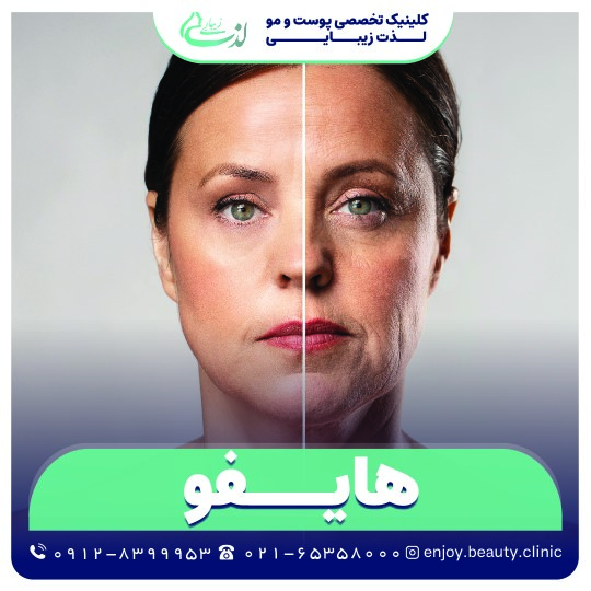 هایپوتراپی