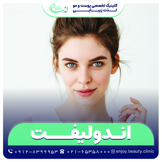 اندولیفت