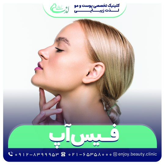 فیس آپ