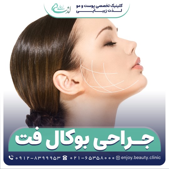 جراحی بوکال فت