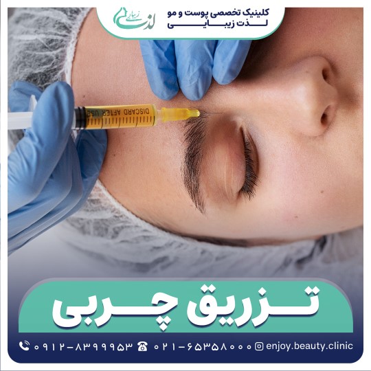 تزریق چربی