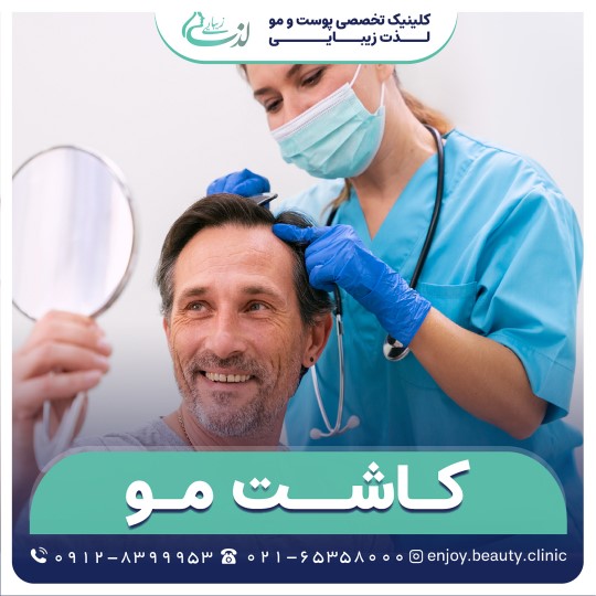 کاشت مو