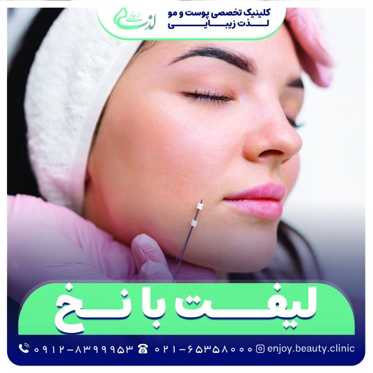 لیفت با نخ