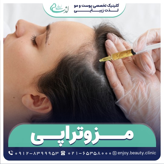 مزوتراپی