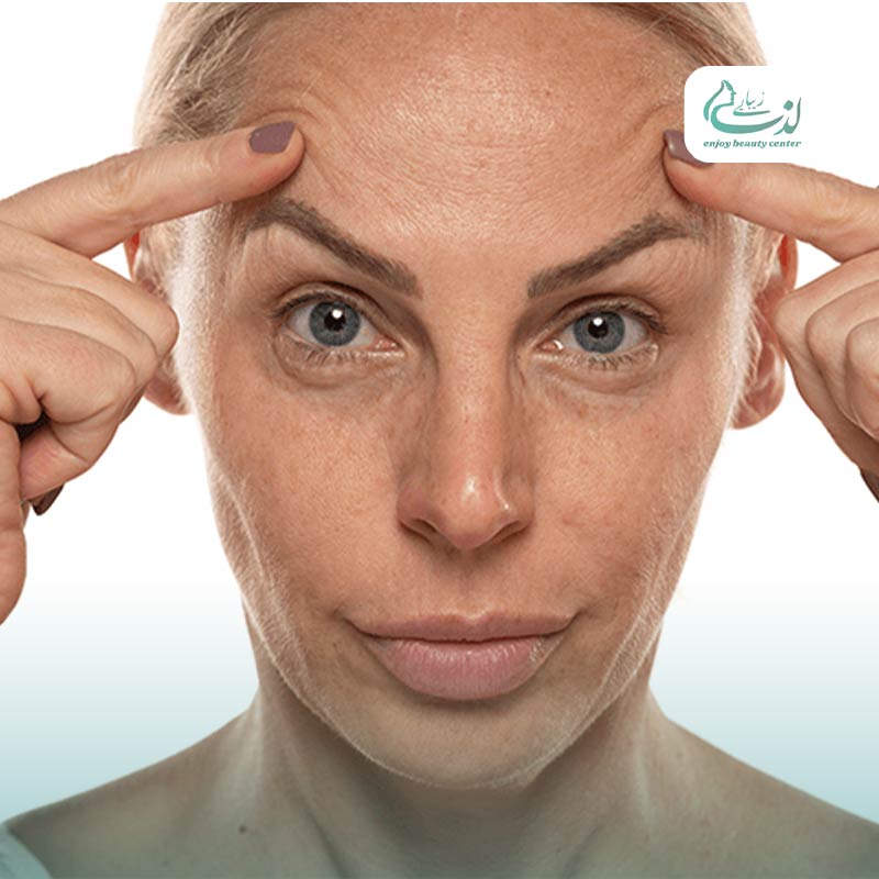 بالا کشیدن ابرو بدون جراحی