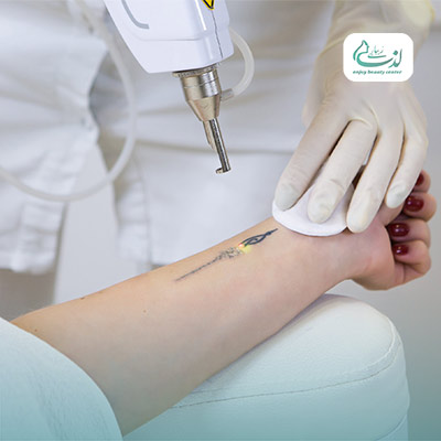 خال برداری